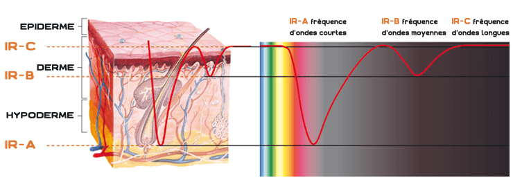 risque sauna infra rouge - onde - peau - cancer